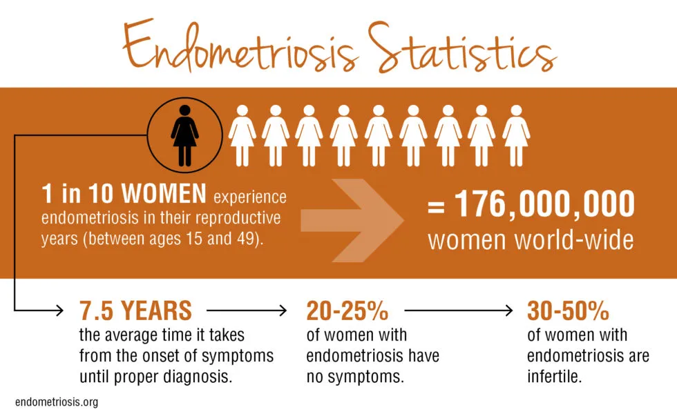 statistics on endometriosis and hormone imbalance